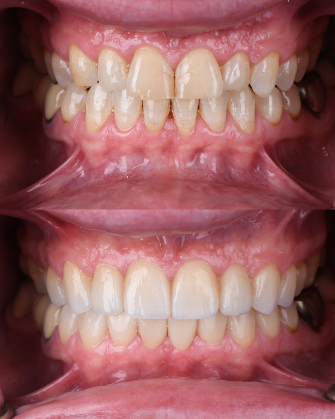 Before and After Case 3